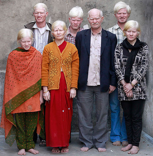 Albino Indians look like an ordinary Swedish family - Gregg, Carl, , Emma, , , Albino, Family, The photo
