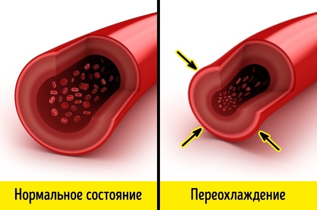 The reaction of our body in extreme situations - A selection, Longpost, Person, Health, Body, Interesting, Not mine, ADME