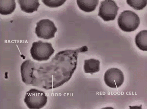 The leukocyte catches the bacterium. - Cell, Bacteria, Hunting, Leukocytes, GIF