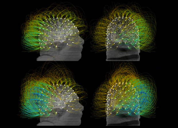 Electrical stimulation partially brought the patient out of the vegetative state - The science, news, The medicine, Technologies, Vegetative state, Electrical stimulation