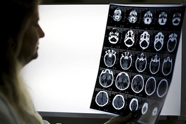 Scientists: After cardiac arrest, the brain continues to work - Brain, Death, Clinical death