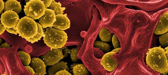 Superbugs will kill us before climate change - Health, Danger, Superbugs, The medicine, Longpost