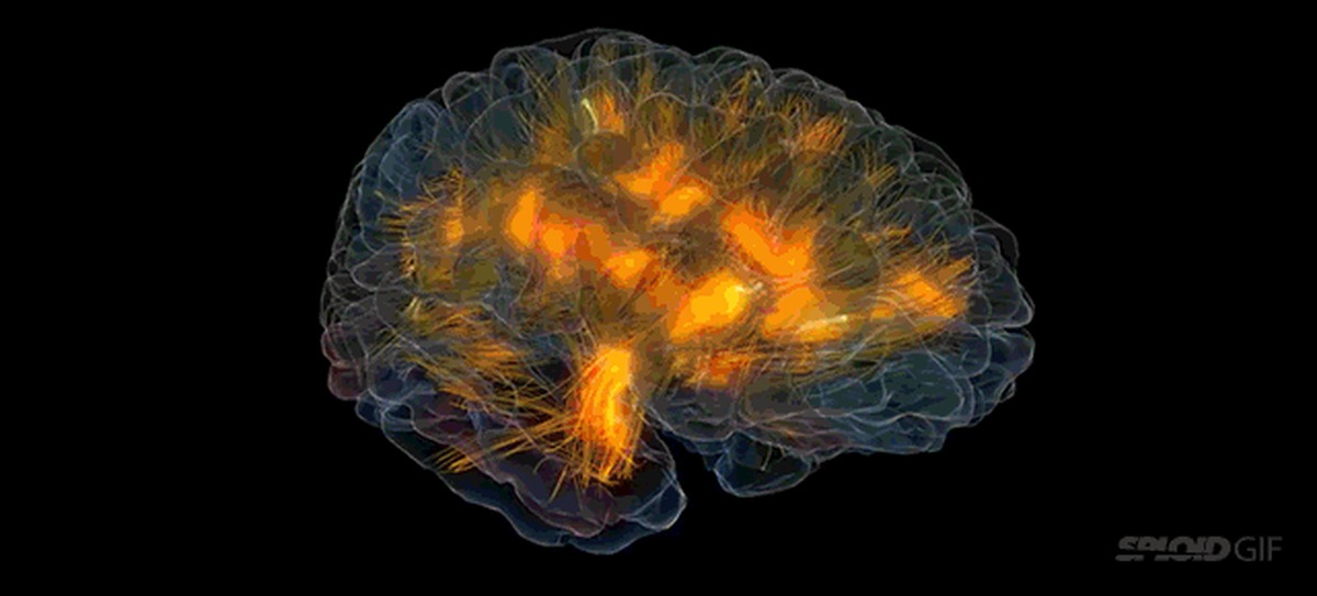 Самый быстрый мозг. Нейронные связи в мозге. Мозг gif. Активность нейронов головного мозга.