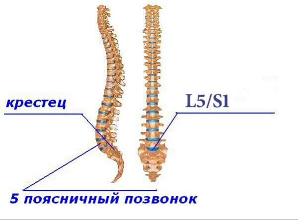 Почему спортсмены и не только вынуждены держать спину ровно? - Позвоночник, Межпозвоночная грыжа, Приседания, Здоровье, Текст, Длиннопост, Вертебрология