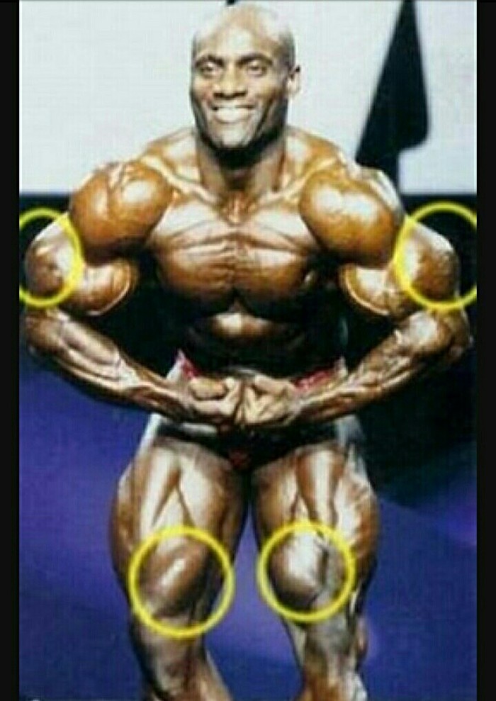 Синтол используют все Синтол, Бодибилдинг, Фрики, Ifbb, Длиннопост