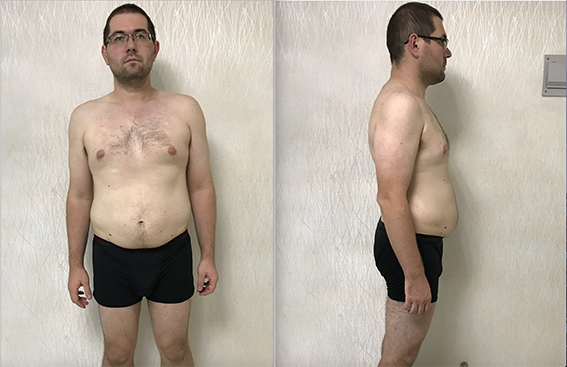 Мое похудение со 130 до 93 кг за сто дней (длиннопост) | Пикабу