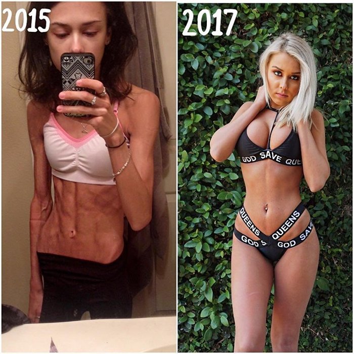 The case when YOU'VE GET GREAT! no longer an insult - NSFW, Anorexia, Health, Longpost