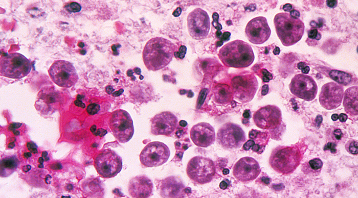 naegleria fowleri что это. Смотреть фото naegleria fowleri что это. Смотреть картинку naegleria fowleri что это. Картинка про naegleria fowleri что это. Фото naegleria fowleri что это