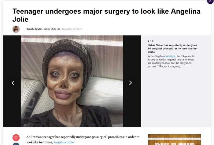 Turning into a lich is a difficult procedure - Plastic surgery, Freaks, Tags are clearly not mine, Freak, Angelina Jolie, Lich