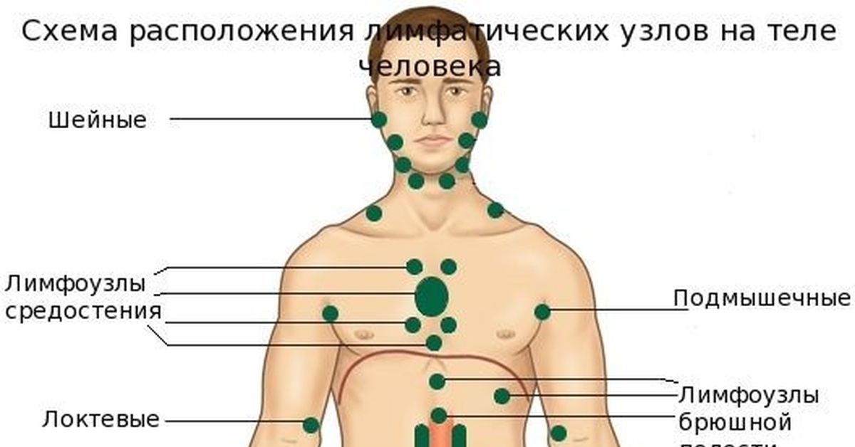 Лимфоузел надпочечнике. Схема лимфоузлов. Схема расположения лимфоузлов на теле человека. Расположение поверхностных лимфатических узлов у человека. Регионарные лимфатические узлы схема.
