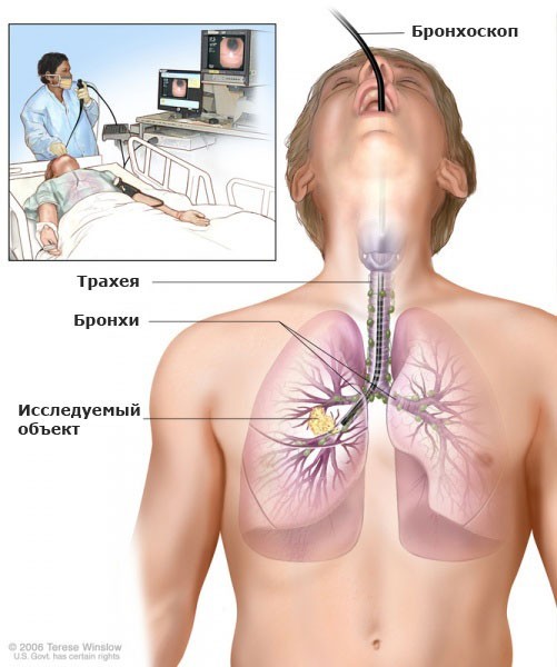 What is it?) - My, Health, Disease, Longpost