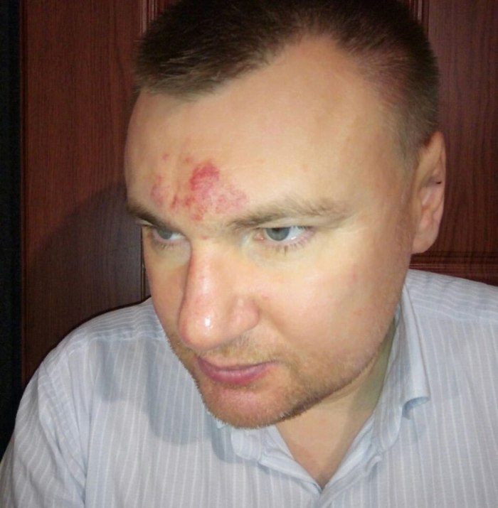 More about the beating of a teacher and a lawyer in Kirov. - Lawlessness, Kirov, Beating, , , , , Anton Dolgikh