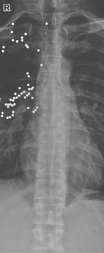 From the life of a radiologist. Part 9 - My, X-ray, The medicine, Longpost