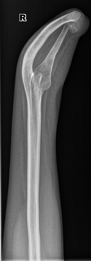 From the life of a radiologist. Part 9 - My, X-ray, The medicine, Longpost