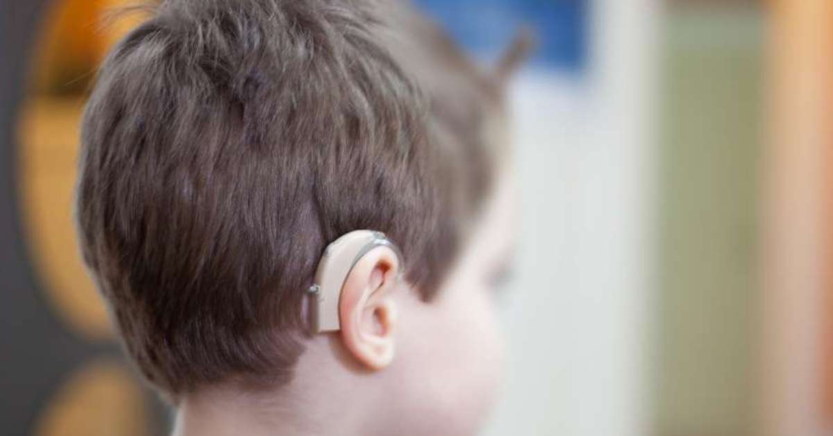 Коррекция детей с нарушениями слуха. Аппарат для глухих кохлеарная имплантация. Аппарат Cochlear кохлеарный. Слуховой аппарат Cochlear 8. Кохлеарный имплант Кохлер.