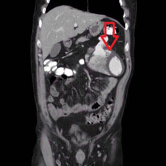 Where is it? - X-ray, Heart, Longpost