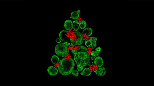 Scientists have created a Christmas tree from stem cells - Society, Scientists, The science, The medicine, Health, Stem cells, Christmas trees, Liferu