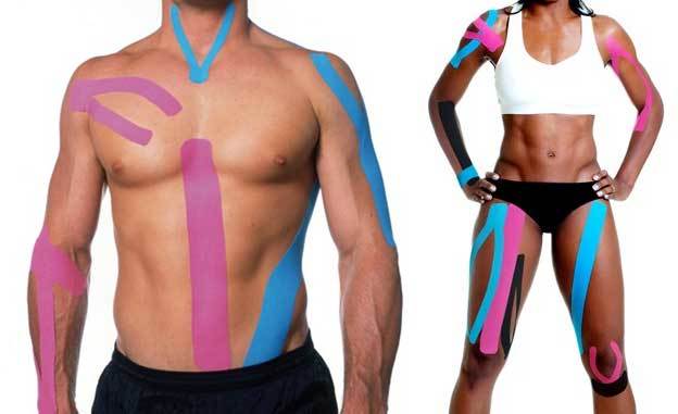 Коротко о кинезиотейпировании