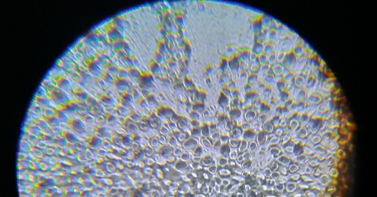 Фото под световым микроскопом