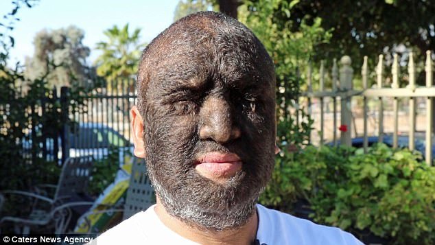 Larry Gomez is the hairiest man on earth - Guinness Book of Records, , Longpost, Hair, Hypertrichosis