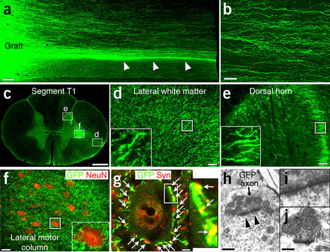 Human stem cells help monkeys recover from spinal cord injury - news, The medicine, Stem cells, Treatment