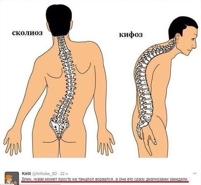 Диагноз - Диагноз, Танцы, Юмор, ВКонтакте