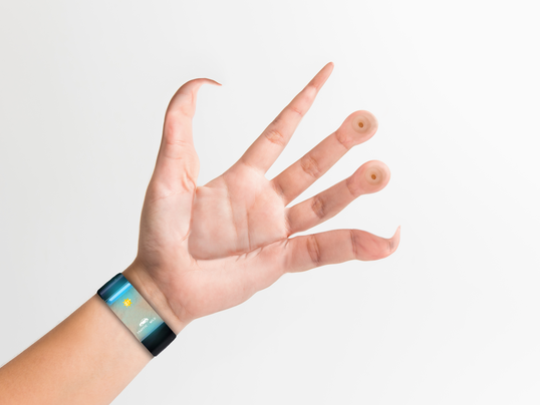 Devices for hands and fingers - A selection, Pinterest, Prosthesis, Accessories, Longpost