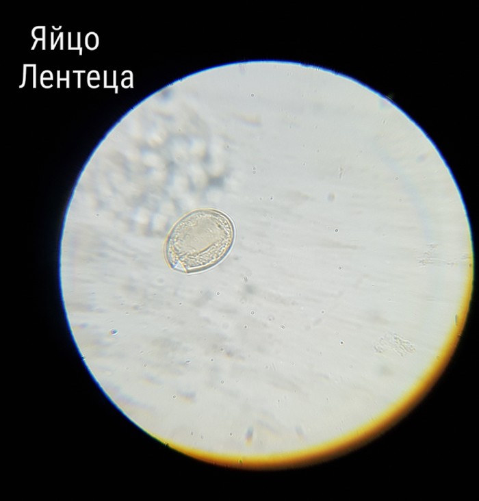 Egg of a wide tapeworm under a microscope - My, Eggs, Biology, Microscope