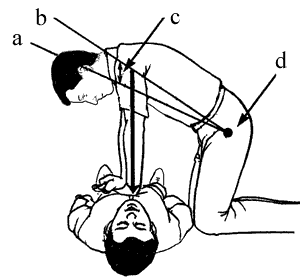 Cardiopulmonary resuscitation - The medicine, Indirect heart massage, First aid, Superheroes, Longpost