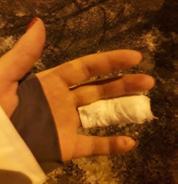 Neighbor bit off Chelyabinsk resident's finger on her birthday because of noisy children - Chelyabinsk, Fingers, Brute force, Longpost, Good neighbors, Negative