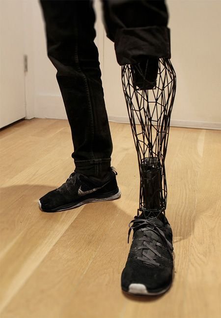 3D printed prosthesis - Prosthesis, Technologies, 3D printer