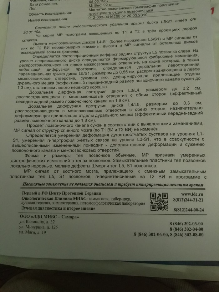 Эндоскопическое удаление грыжи. - Моё, Операция, Нужен совет, Юридическая помощь, Врачи, Лига врачей, Длиннопост