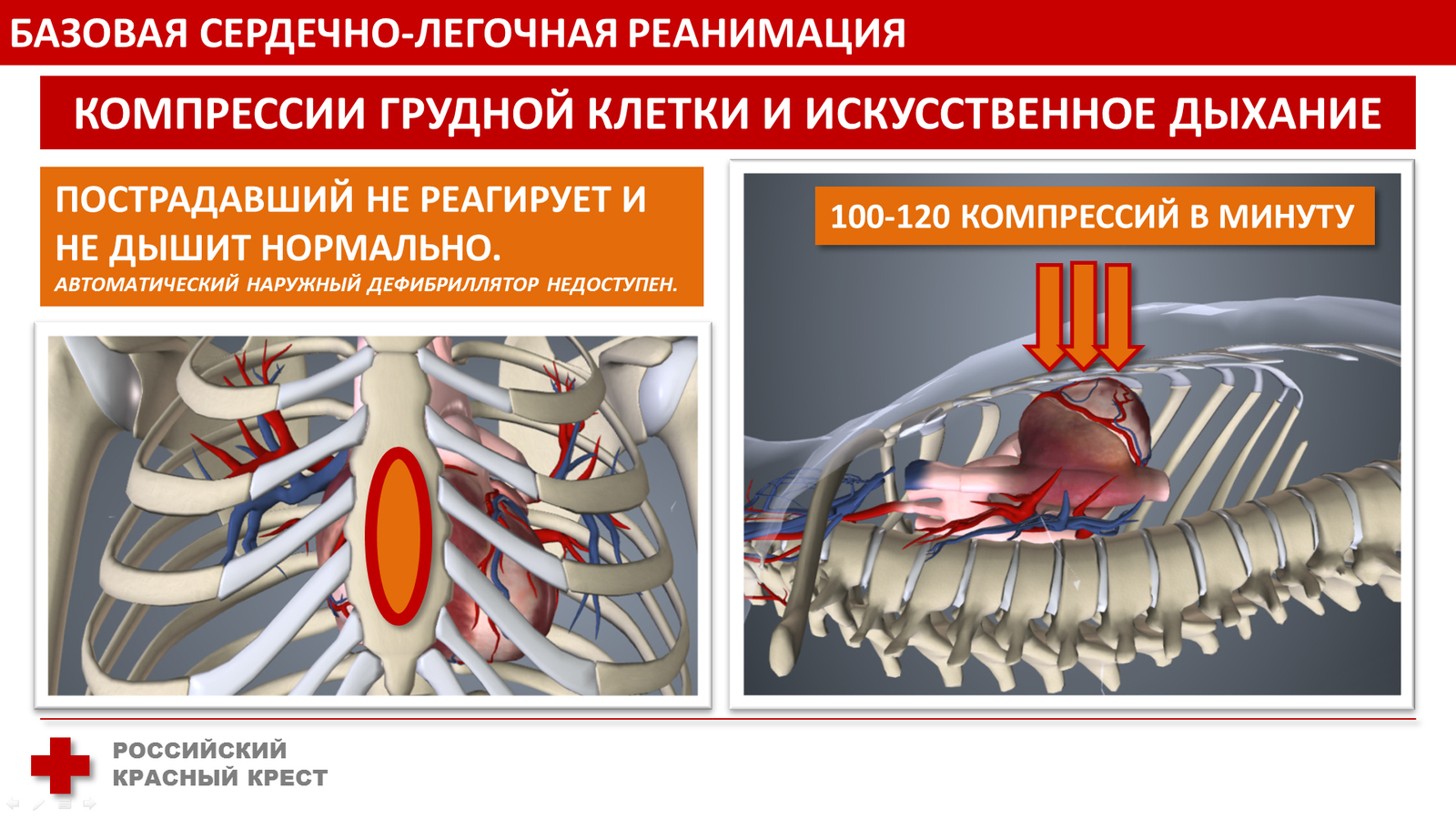 БАЗОВАЯ СЕРДЕЧНО-ЛЕГОЧНАЯ РЕАНИМАЦИЯ | Пикабу