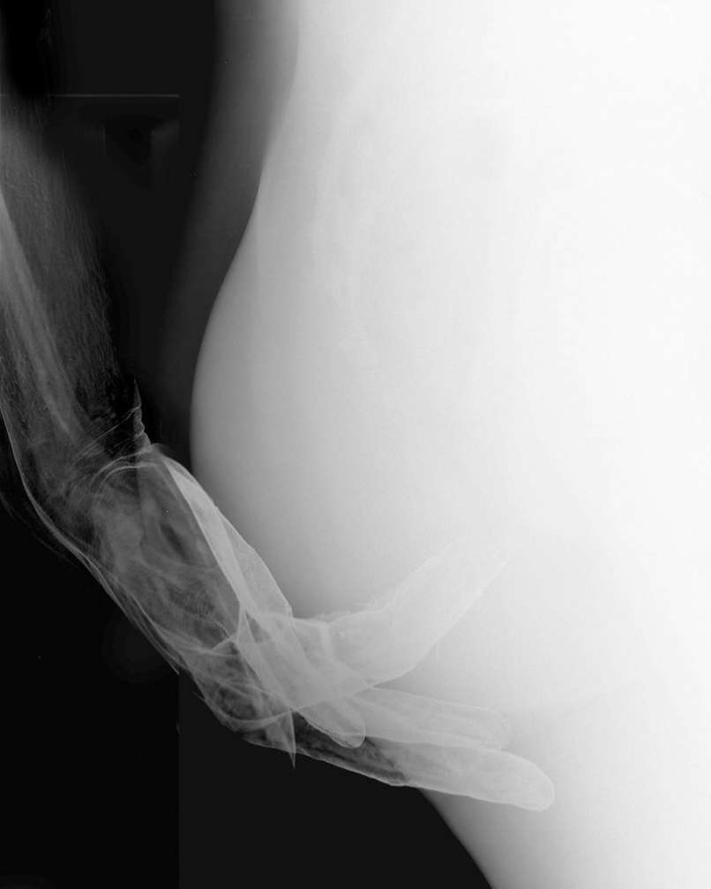 The artist captured the process of sex in x-rays - NSFW, X-rays, Erotic, Sex, beauty, x-ray, Longpost, X-ray