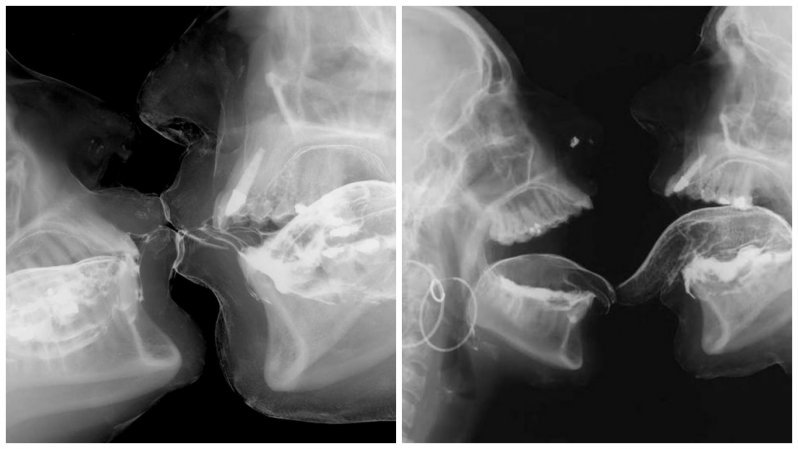 The artist captured the process of sex in x-rays - NSFW, X-rays, Erotic, Sex, beauty, x-ray, Longpost, X-ray