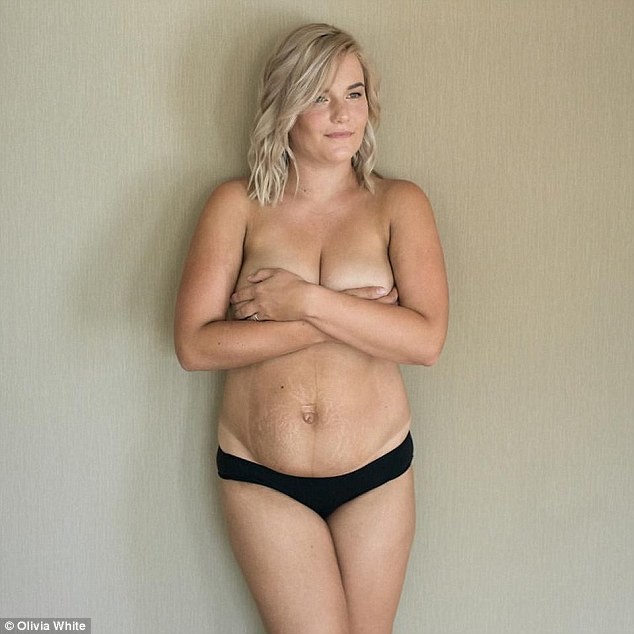 Aussie undresses, speaking out against the fashion for a quick recovery of a figure after childbirth (8 photos) - NSFW, Childbirth, Figure, Longpost