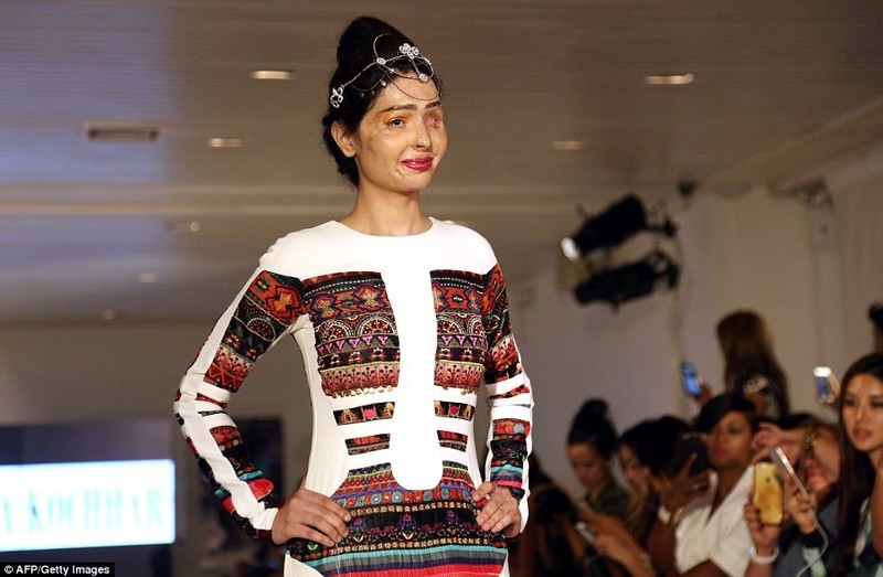 Acid-disfigured Indian model walks the catwalk in New York - India, Tragedy, Models, Strength of mind, Longpost