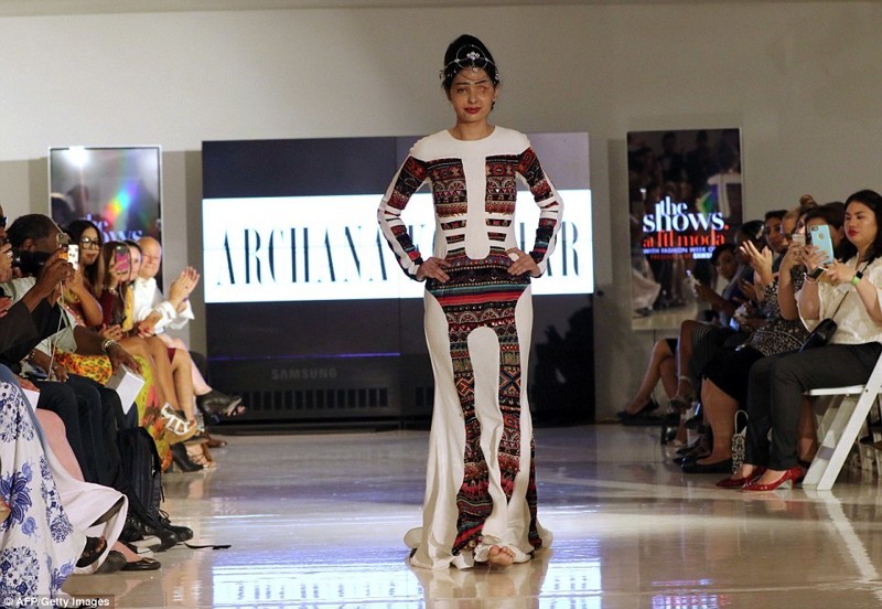 Acid-disfigured Indian model walks the catwalk in New York - India, Tragedy, Models, Strength of mind, Longpost