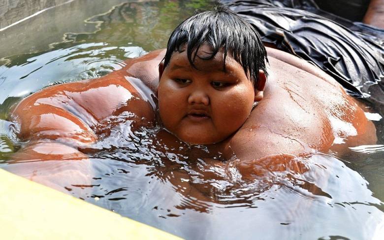 Arya Permana is the fattest child in the world - Events, Society, Health, Peace, Indonesia, Boy, Excess weight, Longpost