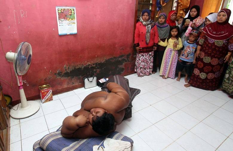 Arya Permana is the fattest child in the world - Events, Society, Health, Peace, Indonesia, Boy, Excess weight, Longpost