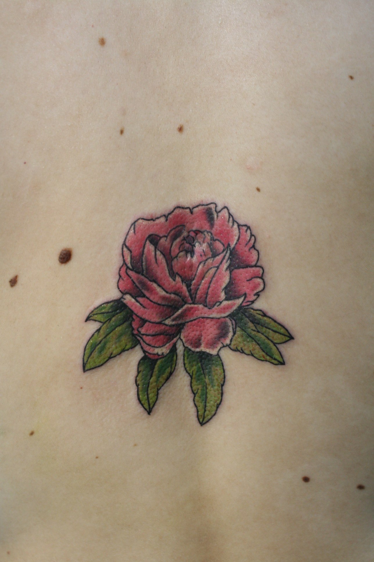 How did they close my scar? - My, My, Tattoo, Flowers, Scar, Joy, Photo, Longpost