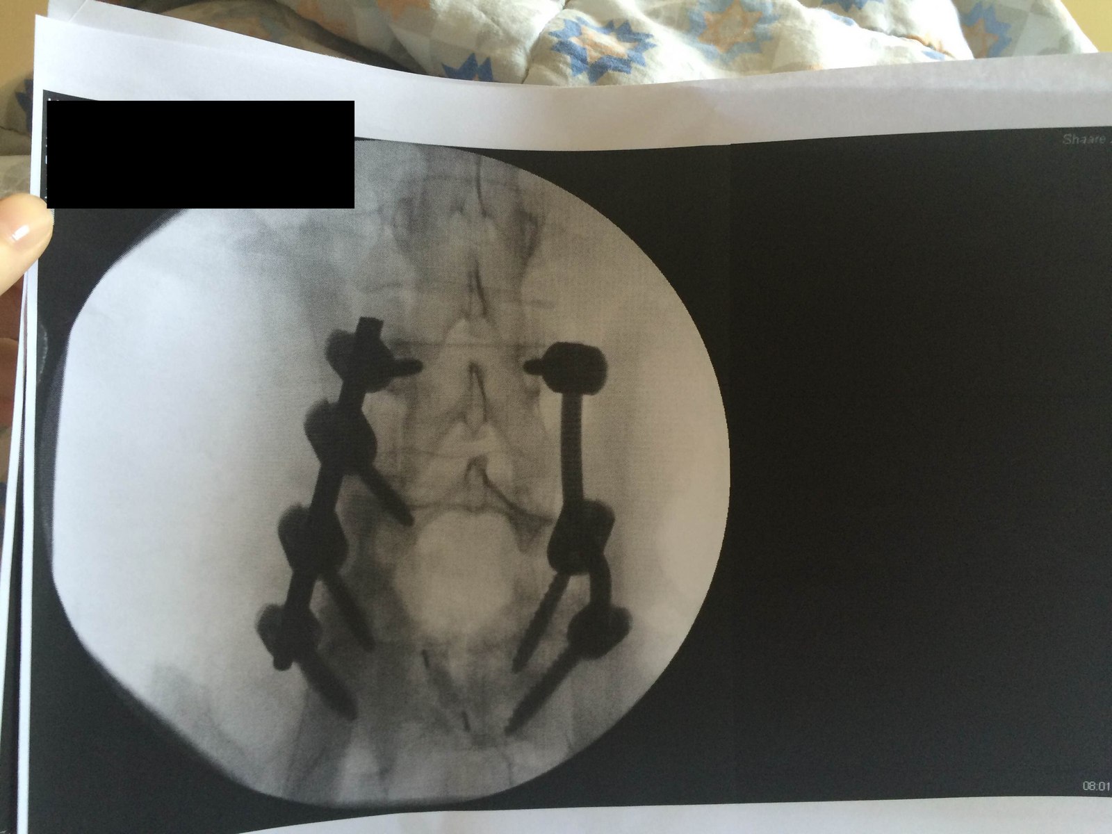 Medical tourism №2 - My, Medical Tourism, Israel, The medicine, Longpost