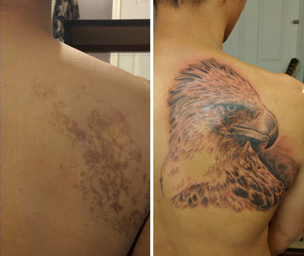 Tattoos that ingeniously hide birthmarks - Birthmarks, Disguise, Longpost, Tattoo