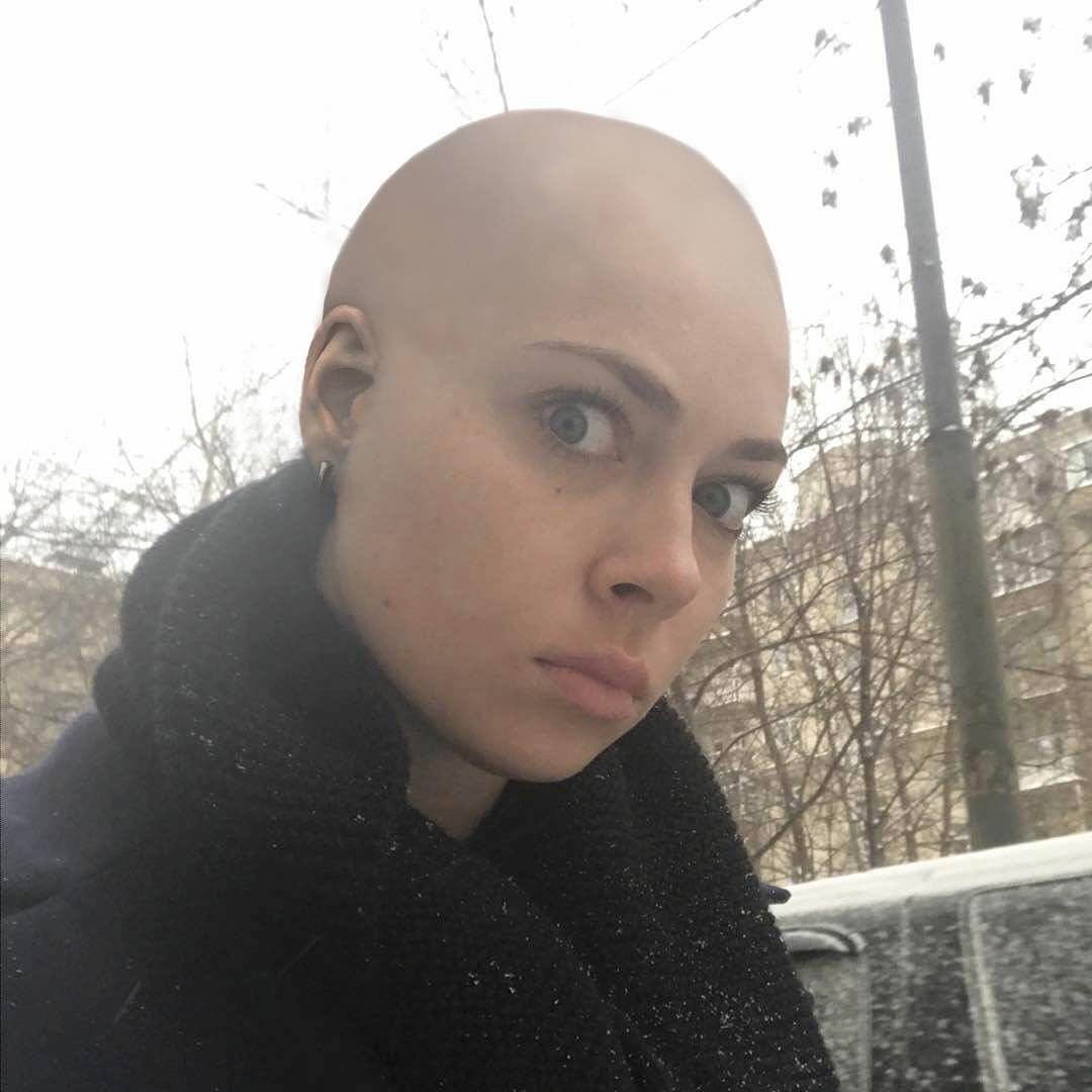 Answered - Nastasya Samburskaya, bald, University