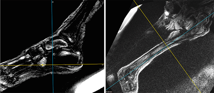 The mummy continues to uncover mysteries - Grave, Mountain Altai, Pazyryk culture, MRI, Ukok Plateau, Longpost, Altai Republic