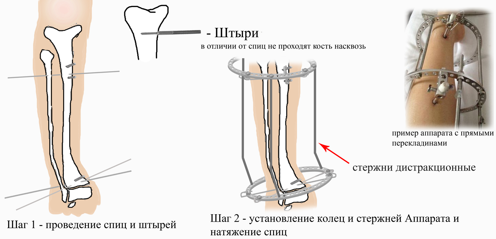 Схема центра илизарова