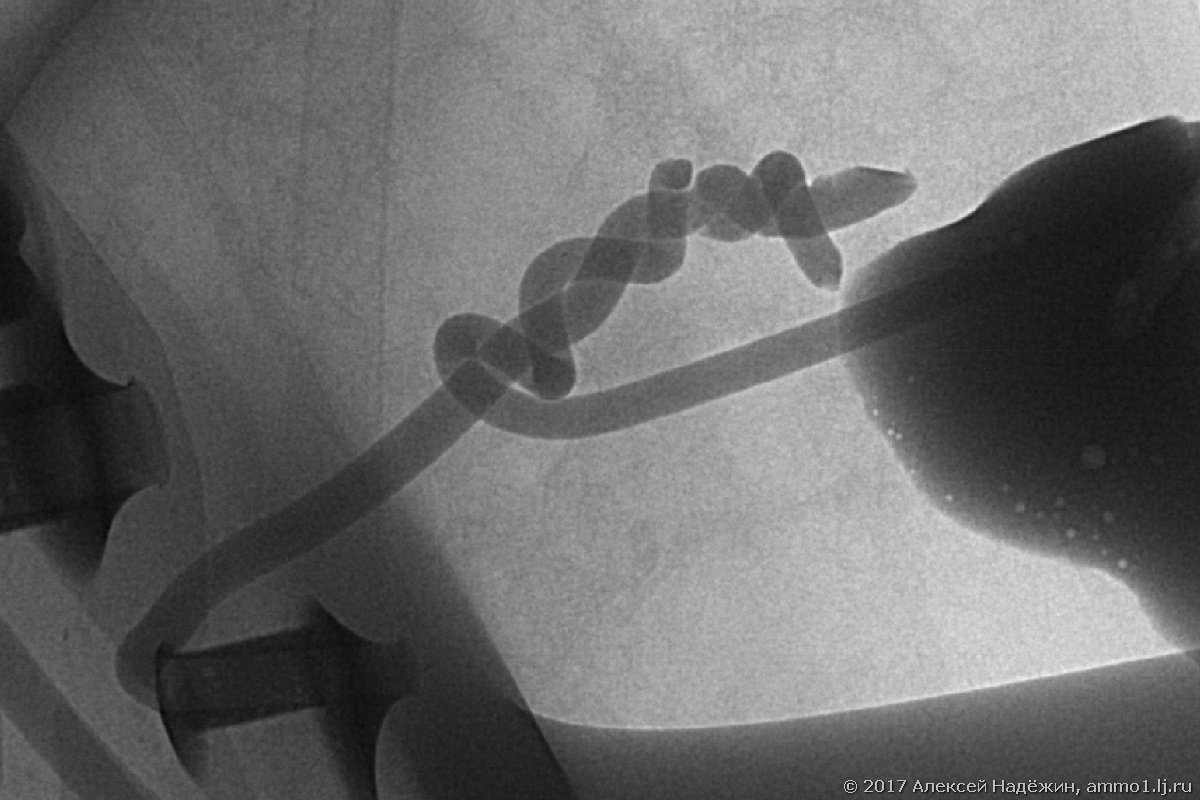 Entertaining radiography - My, X-ray, LED lights, Longpost, My, Filament