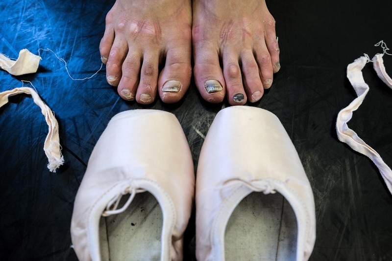 Правда о ножках балерин. Мифы, реальность и фотографии. | Пикабу