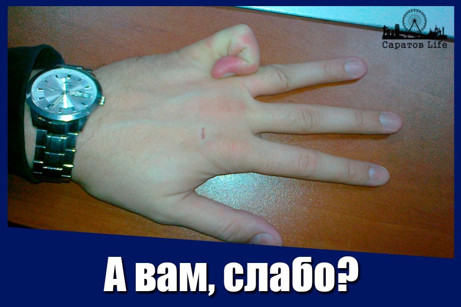 Drunken Balakovo resident weakly chopped off his brother's finger - Saratov, Balakovo, Are you weak?, Fingers