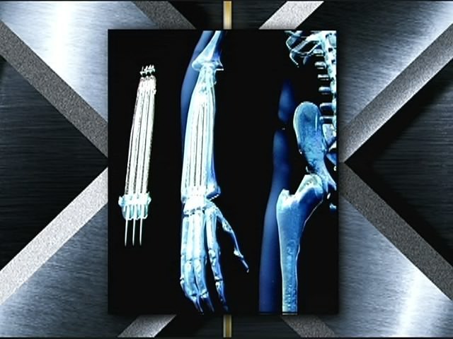 The structure of the claws of Wolverine - Wolverine, Wolverine X-Men, X-Men, Structure, GIF, Longpost, Logan